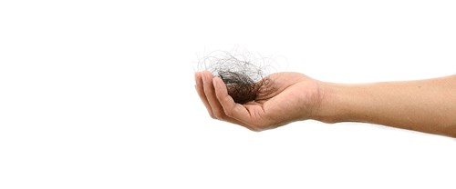 Hair Loss Solutions-Services